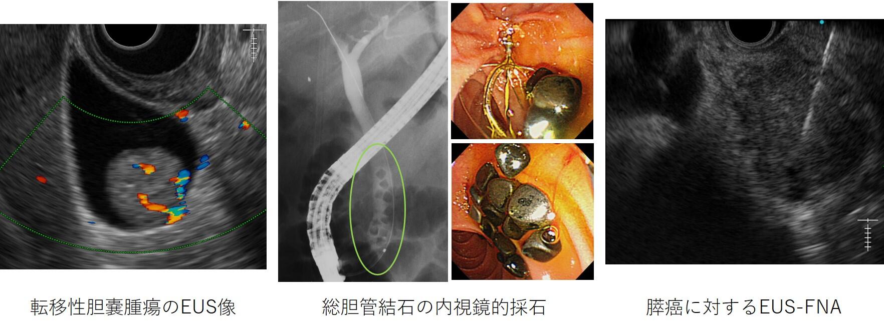 消化器内科（胆・膵）:基本情報 – 虎の門病院