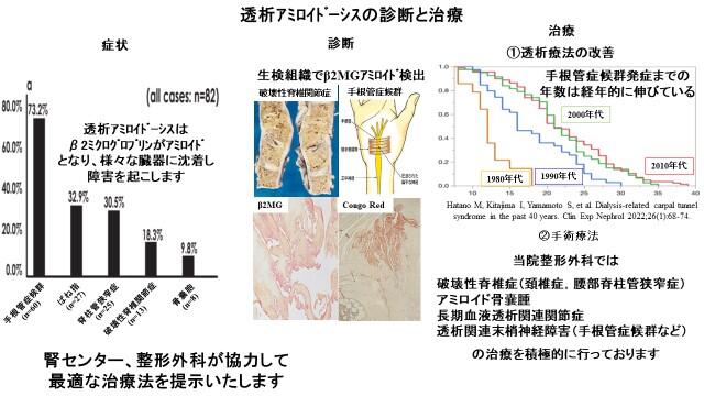 透析アミロイドーシスと骨・関節障害 | 圓尾 宗司 |本 | 通販