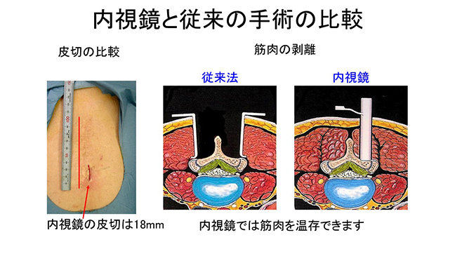 脊椎センター 虎の門病院